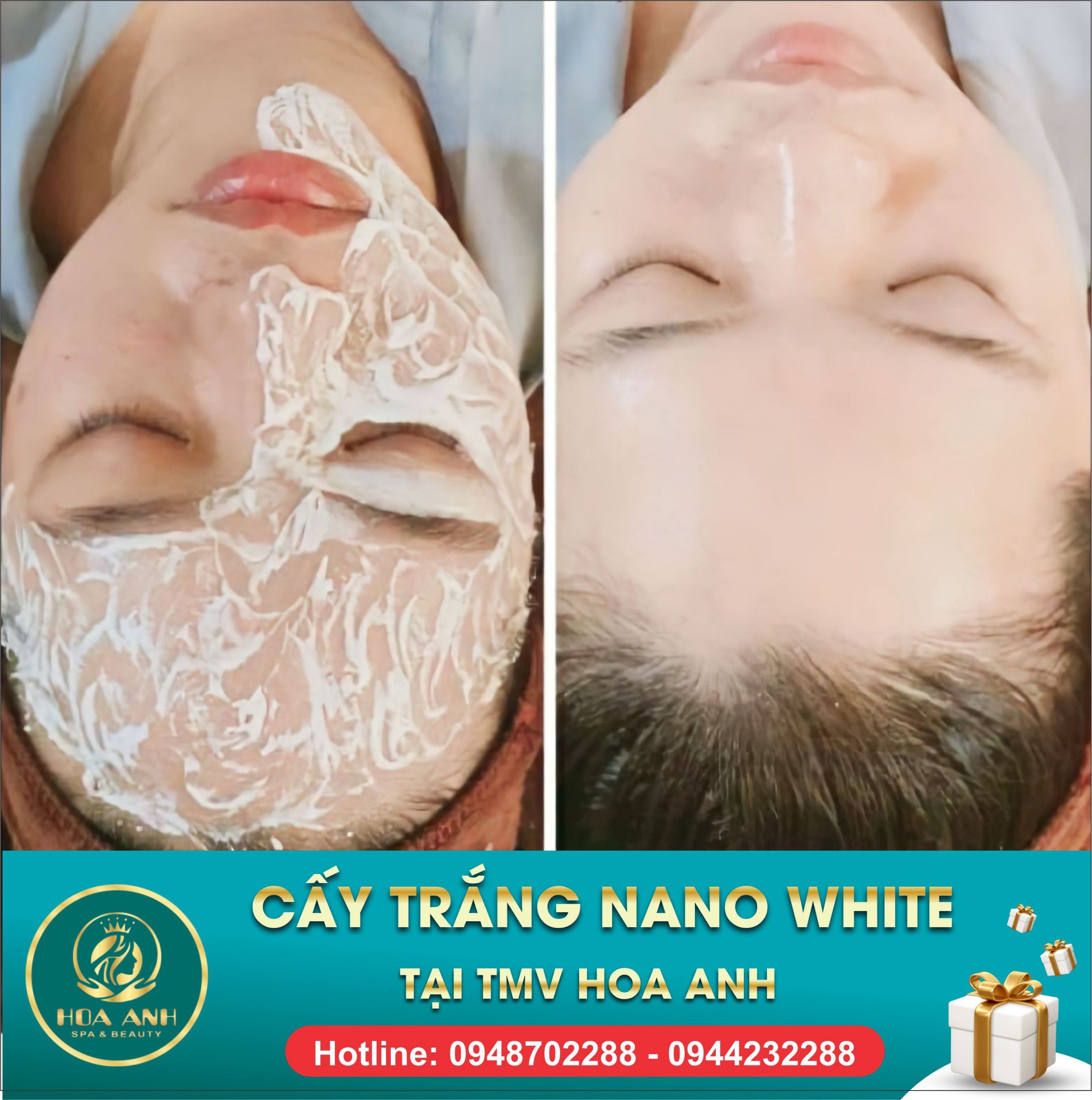 Tổng hợp thông tin về phun môi Collagen là gì Nên chọn màu nào Thẩm