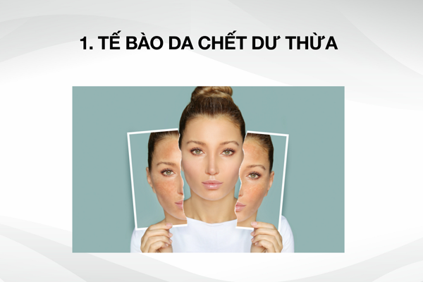 9 lý do khiến làn da của bạn ngày càng xỉn màu dù đã được che chắn kỹ càng