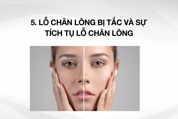 9 lý do khiến làn da của bạn ngày càng xỉn màu dù đã được che chắn kỹ càng