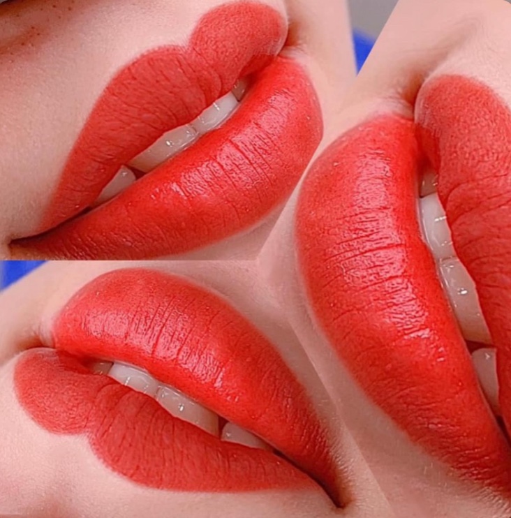  PHUN MÔI CHÂU ÂU- SIÊU CĂNG MỊN Tại Thẩm Mỹ Viện Hoa Anh Cà Mau