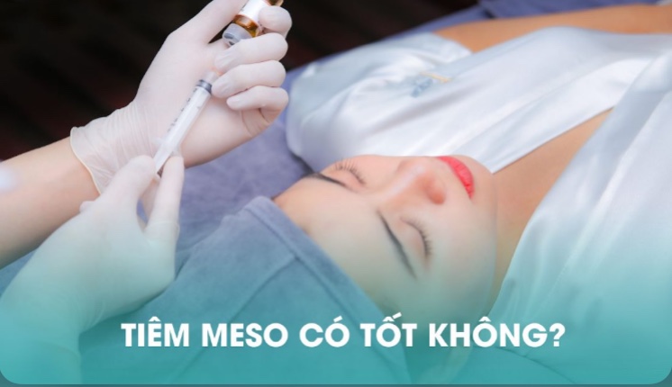 TIÊM MESOTHERAPY. Tại Cà Mau
