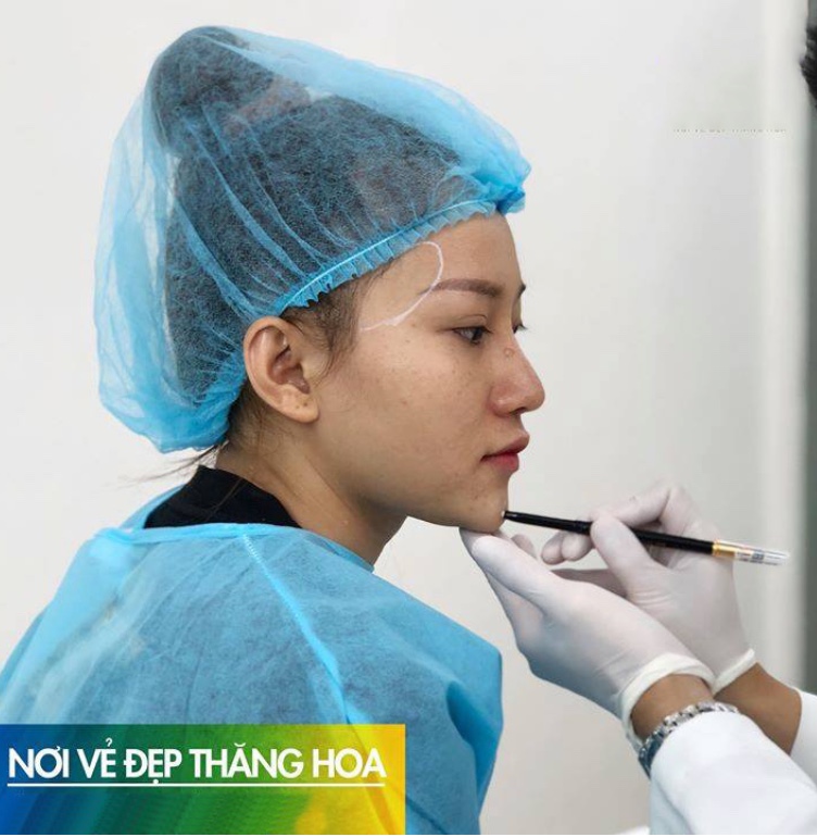 CÁCH CHĂM SÓC SAU TIÊM FILLER Tại Thẩm Mỹ Viện Hoa Anh Cà Mau