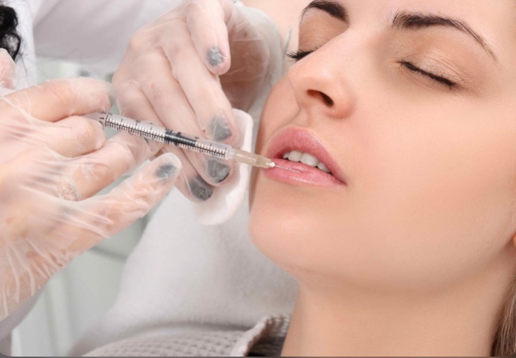 Tại sao nên tiêm Filler môi tại cà mau