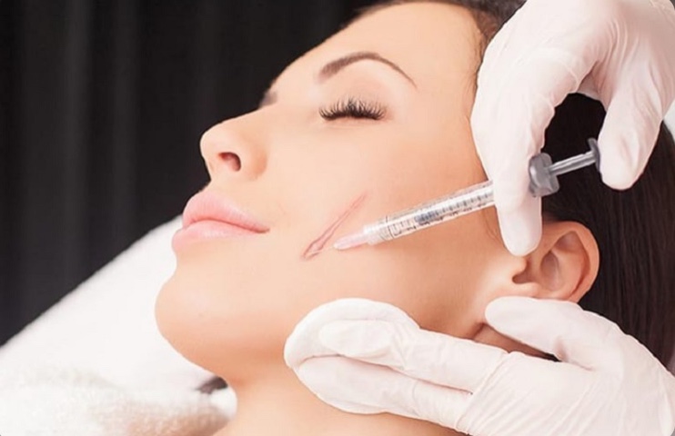 Ai nên tiêm sẹo lồi? Tiêm sẹo lồi có hết không? Tại Cà Mau