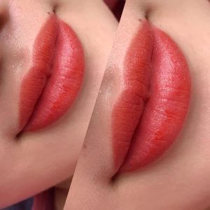 chăm sóc môi sau khi bong vảy