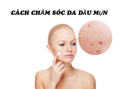 cách chăm sóc da dầu mụn