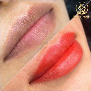 chăm sóc môi sau phun