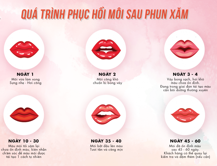 quá trình phục hồi môi sau khi xăm