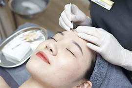 điều trị mụn chuẩn y khoa