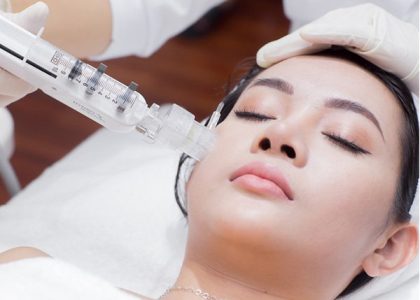 cấy collagen tươi