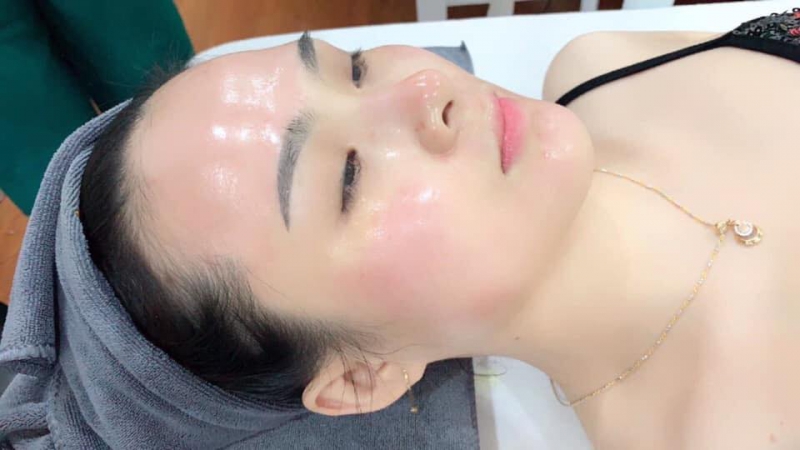 cấy collagen căng bóng da