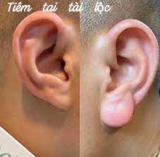 tiêm tai tài lộc