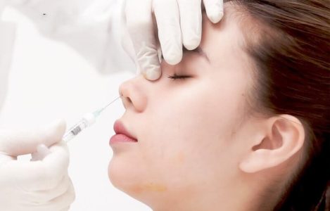 filler nâng mũi