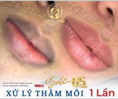thẩm-mỹ-hoa-anh