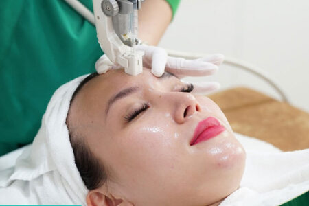 cấy collagen da căng bóng