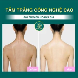 tắm trắng phi thuyền
