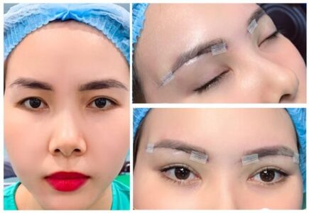 nâng cung chân mày