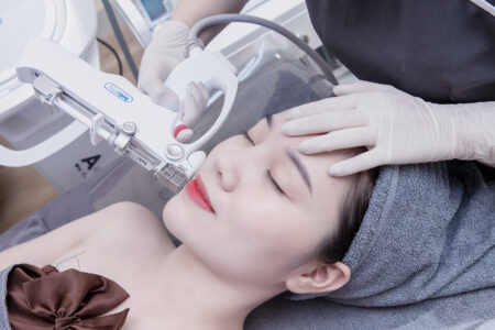 cấy mesotherapy