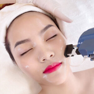 cấy collagen tươi