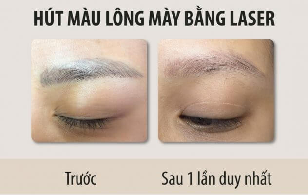 kem che khuyết điểm
