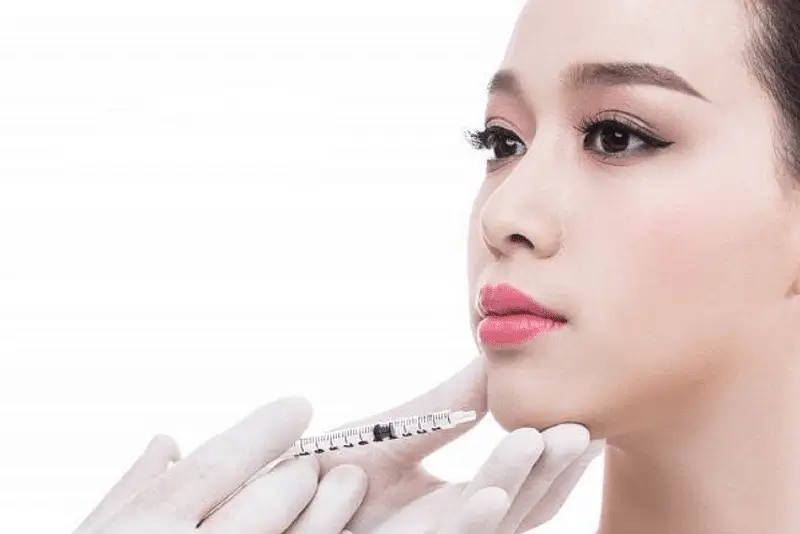 tiêm cằm vline