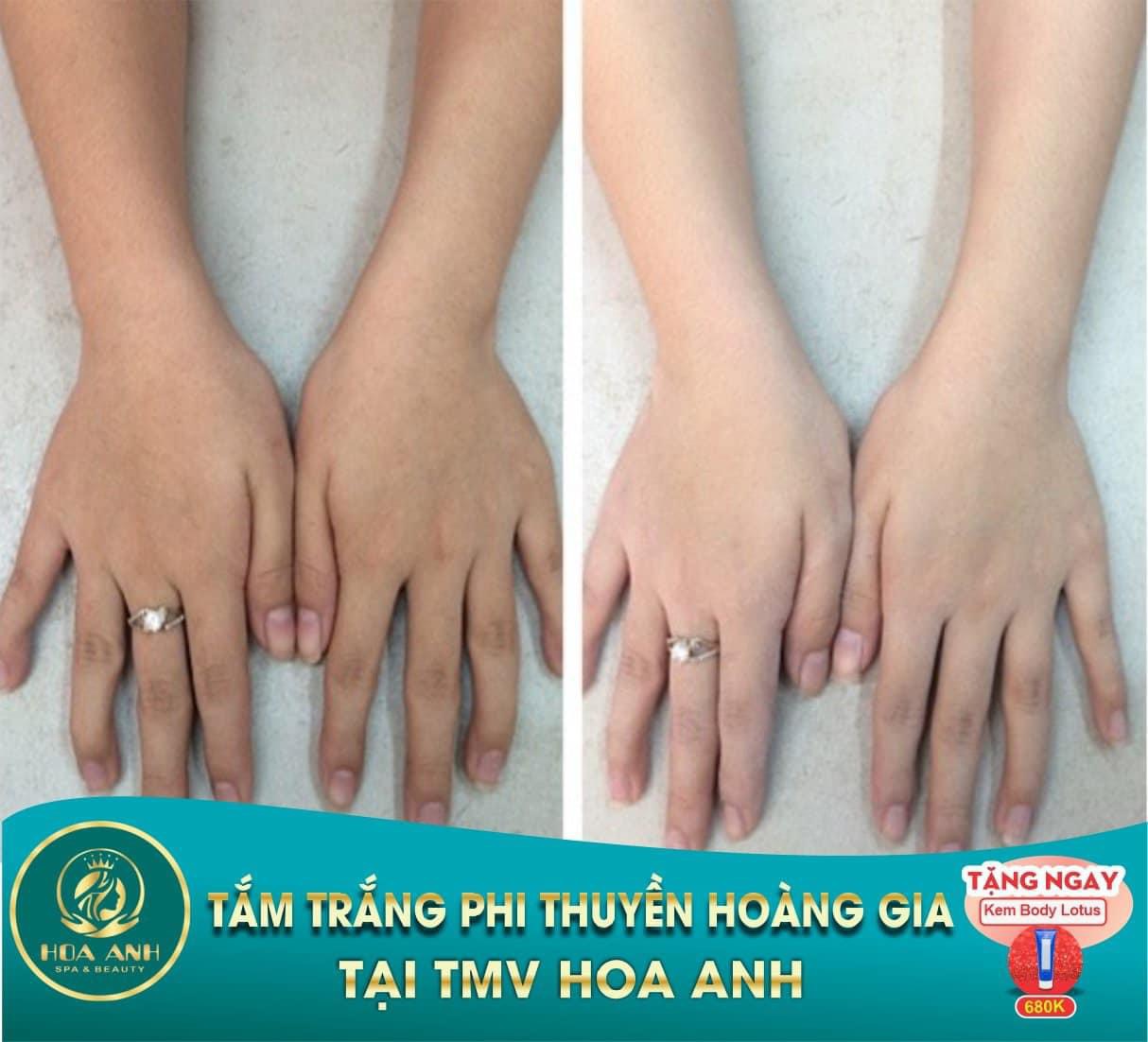 tắm trắng phi thuyền