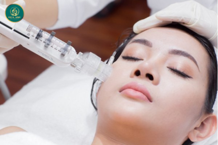 cấy collagen căng bóng