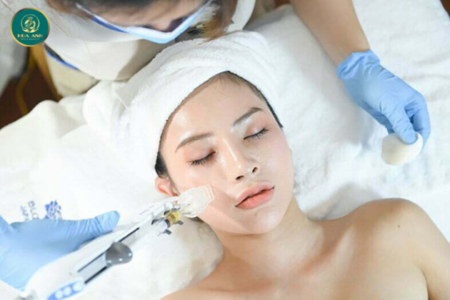 Cấy meso căng bóng