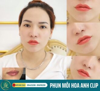 phun môi hoa anh