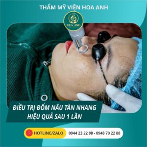laser xóa đồi mồi, tàn nhang