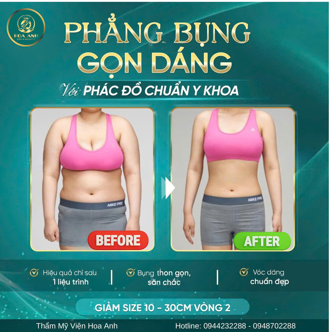 giảm béo cấp tốc