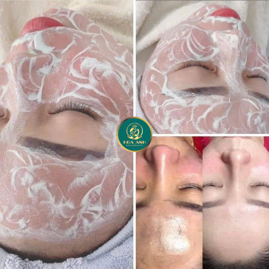 cấy trắng da