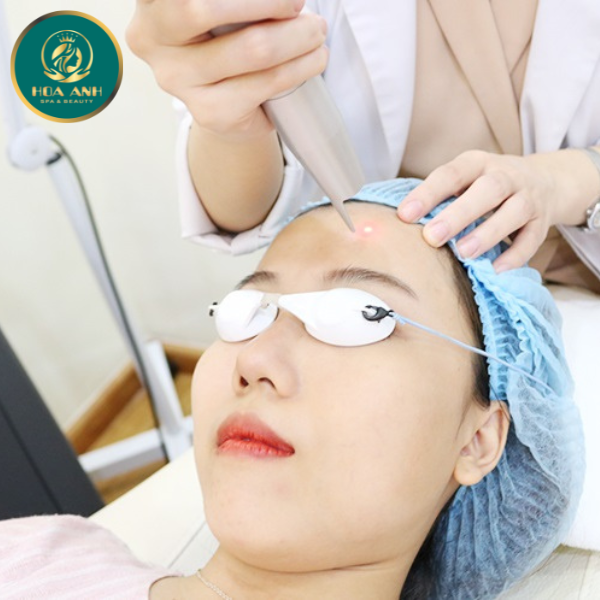 laser xóa nốt ruồi, mụn thịt
