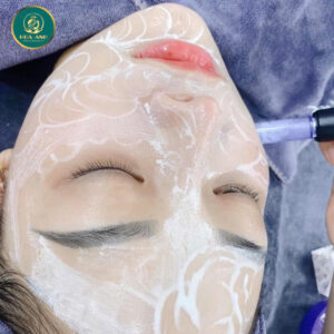 cấy trắng da mặt