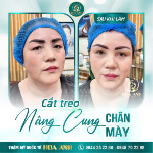 treo cung chân mày