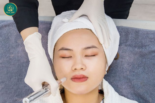 cấy trắng da mặt