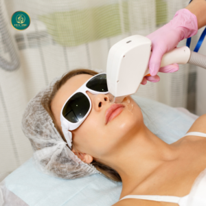 triệt lông vĩnh viễn