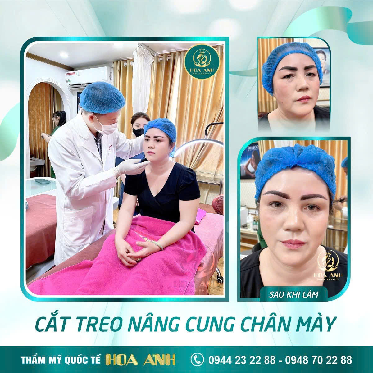 treo cung chân mày