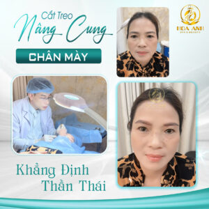 treo cung chân mày
