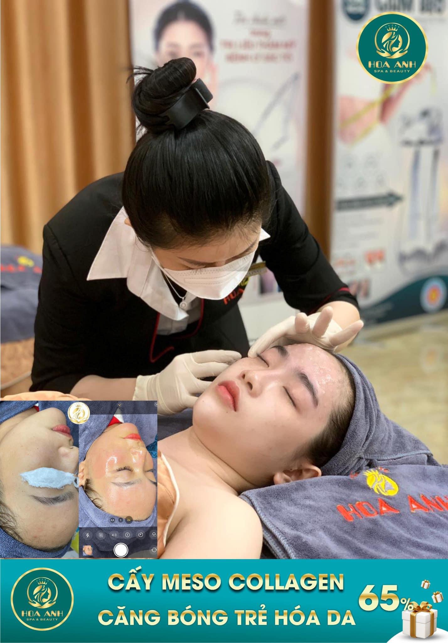 cấy meso căng bóng
