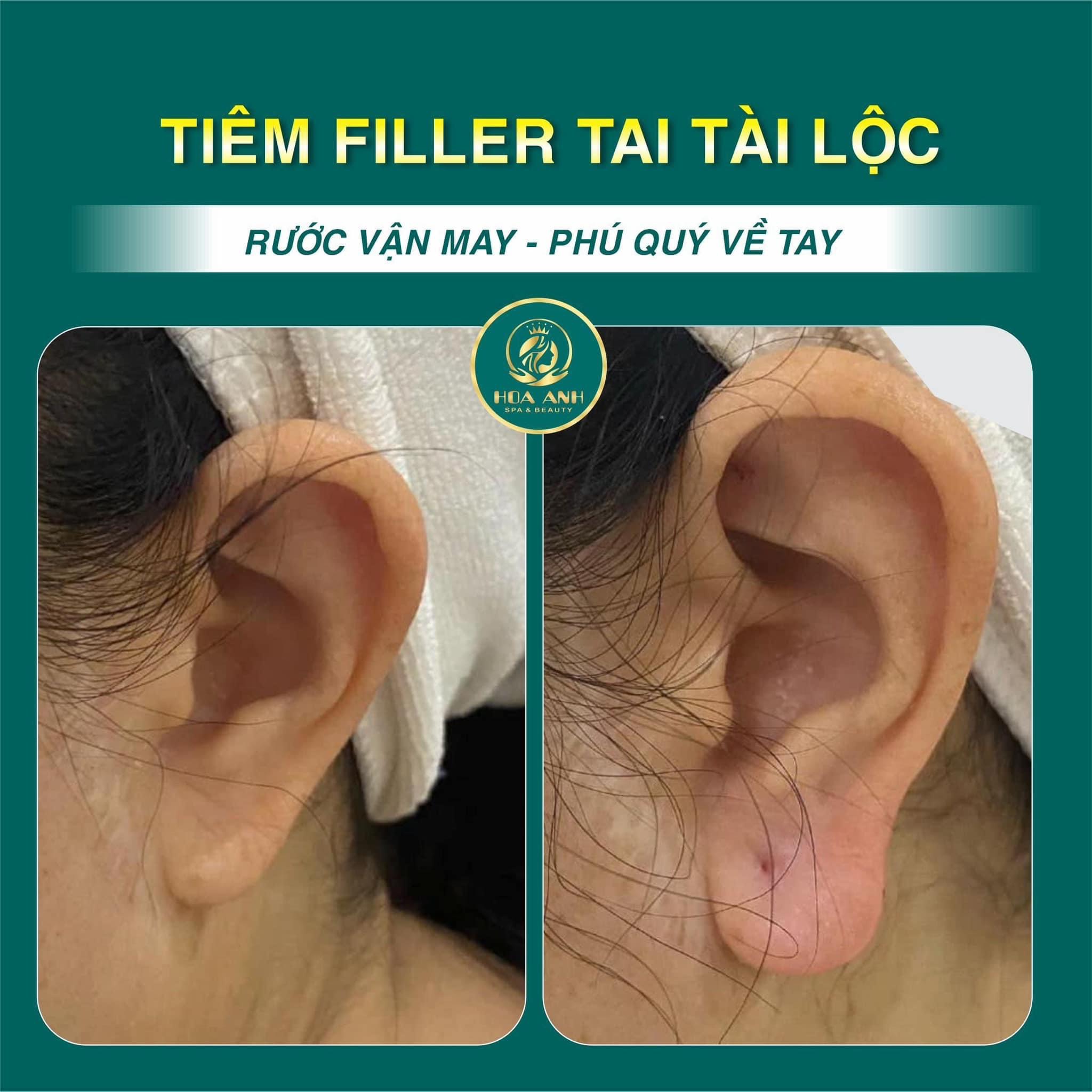 tiêm tai phong thủy