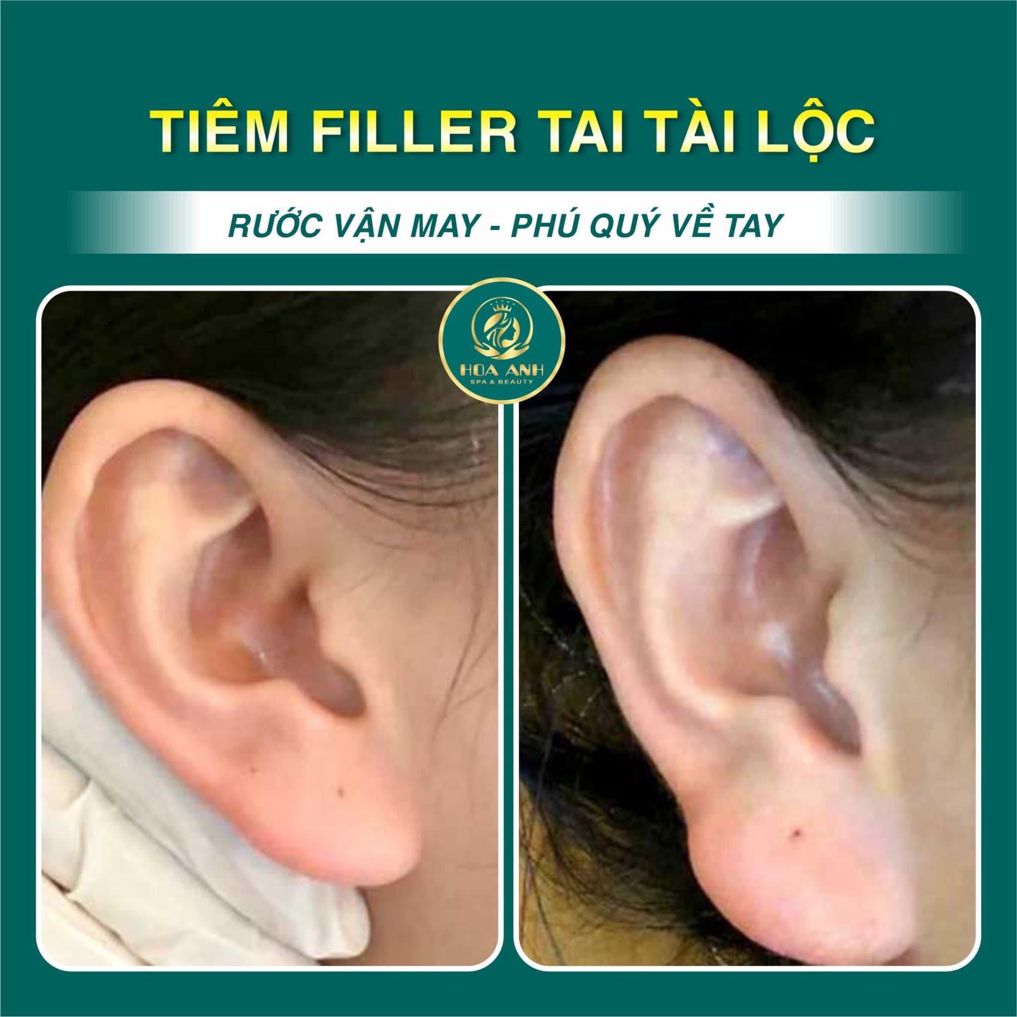 tiêm tai phong thủy