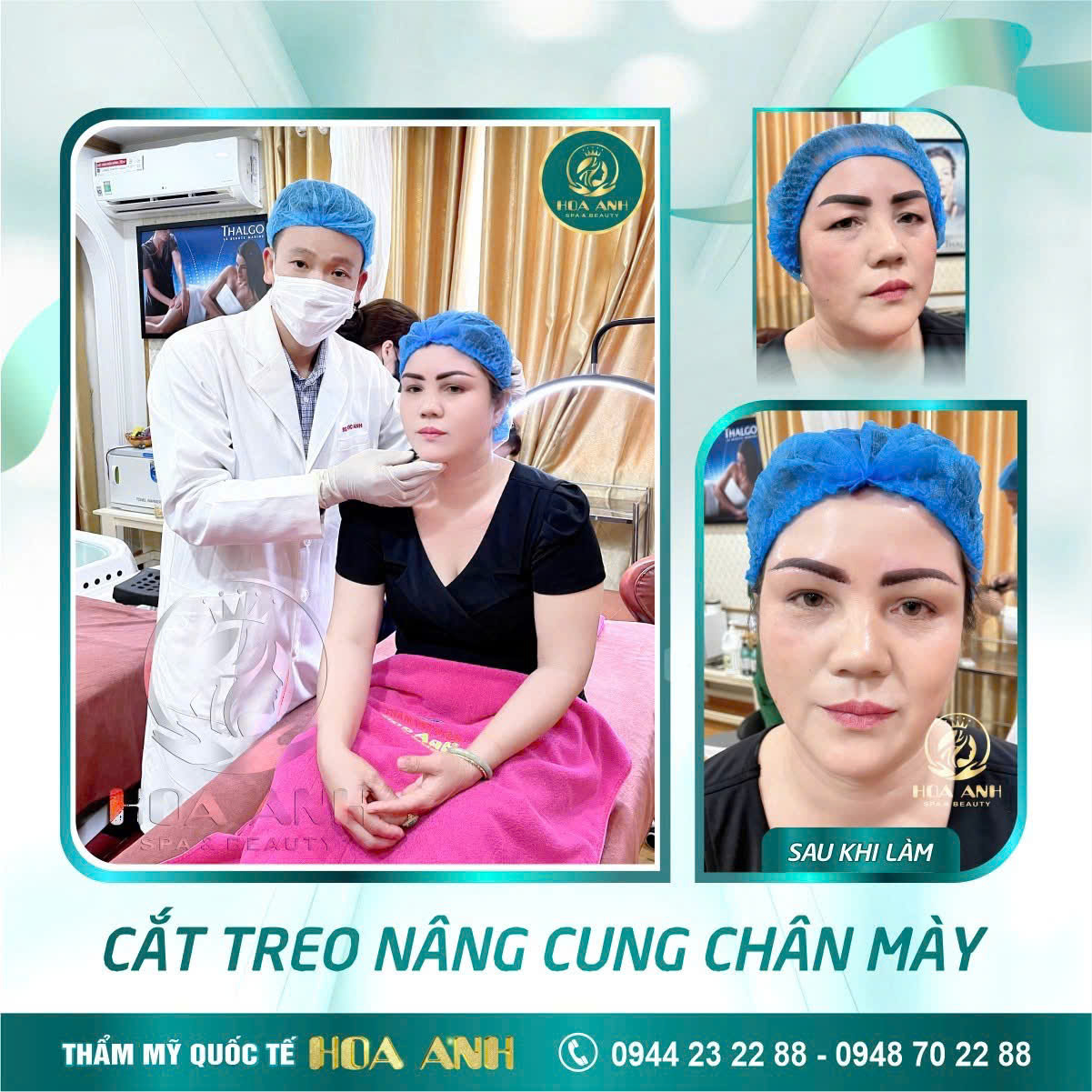 treo cung chân mày