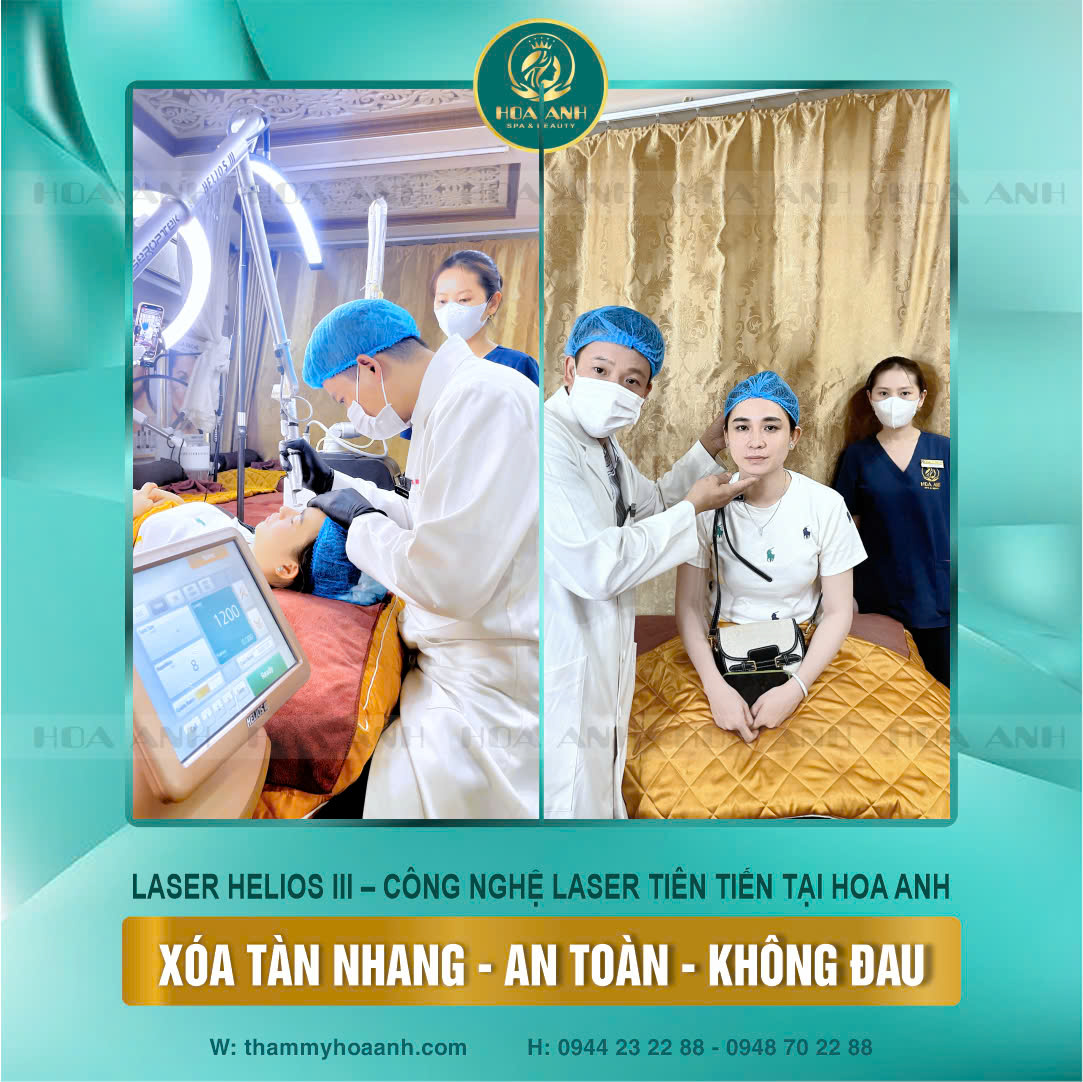laser xóa mụn thịt