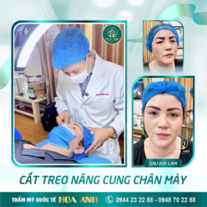 treo cung chân mày