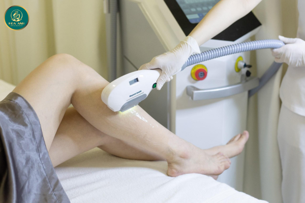 triệt lông vĩnh viễn