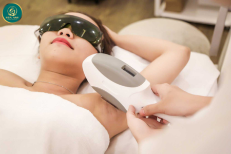 triệt lông vĩnh viễn