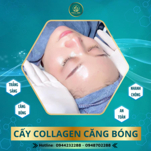 cấy collagen căng bóng