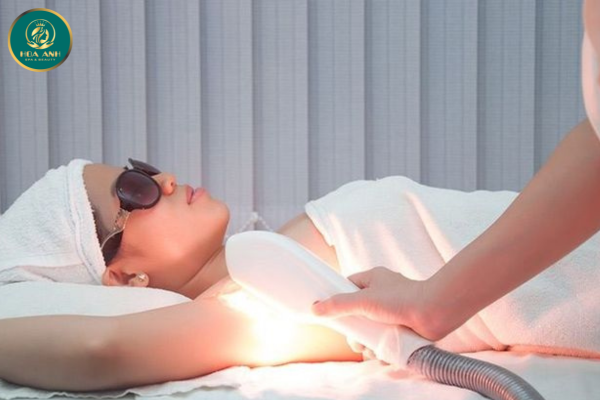 triệt lông vĩnh viễn