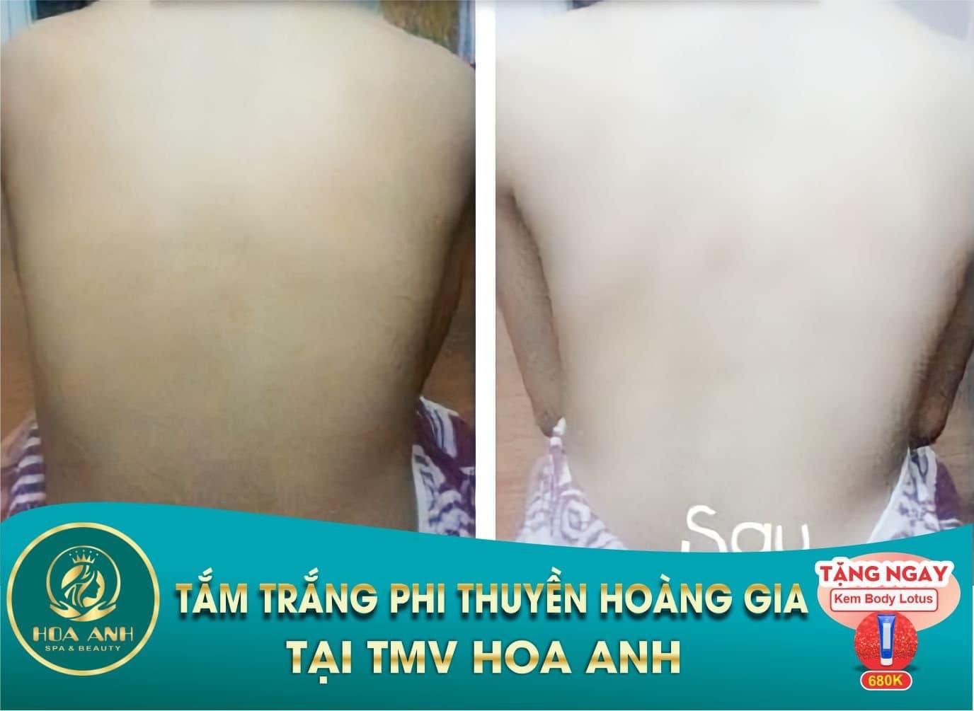 tắm trắng phi thuyền